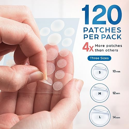 KEYCONCEPTS Pimple Patches for Face (120 Pack), Hydrocolloid Patch with Tea Tree Oil - Pimple Patch Zit Patch and Pimple Stickers - Hydrocolloid Acne Patches for Face - Zit Patches - Blemish Patches