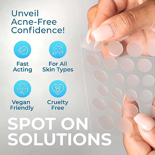 KEYCONCEPTS Acne Patches (120 Count) with Tea Tree Oil, Hydrocolloid Pimple Patches for Face - Zit Patch Acne Dots - Cystic Acne Patches - Pimple Patch with 3 Size Acne Stickers